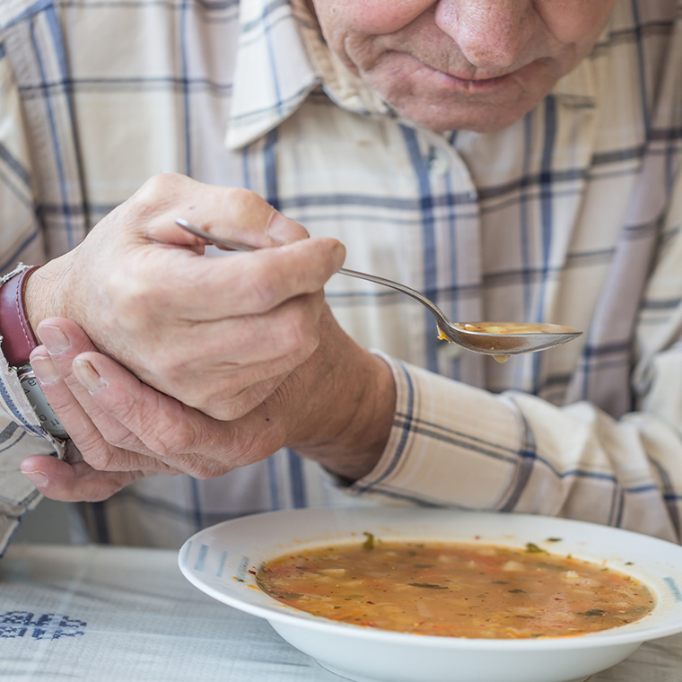 El Parkinson es una enfermedad neurodegenerativa que afecta el control de los movimientos del cuerpo.