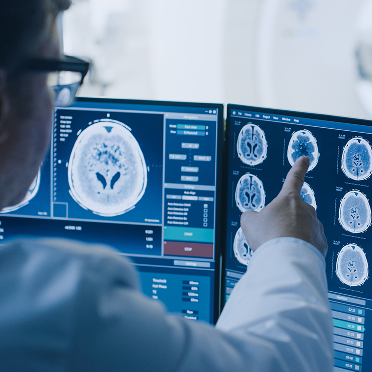 El Código Stroke es un protocolo clínico que activa toda la cadena de atención dentro de un Hospital a la llegada de un paciente con sospecha de stroke, con el objetivo de brindar atención de inmediato para evitar o minimizar el daño cerebral.