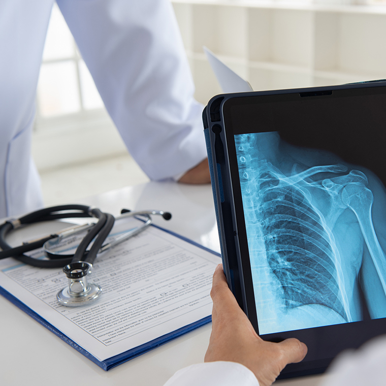 La radiología es una especialidad que combina la obtención de imágenes y la tecnología para obtención de diagnóstico y orientación en el tratamiento médico.