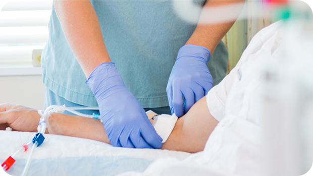 fistula-arteriovenosa-interna