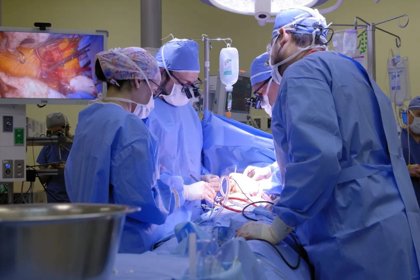 TecSalud realiza implante cardiaco pionero para falla cardiaca severa