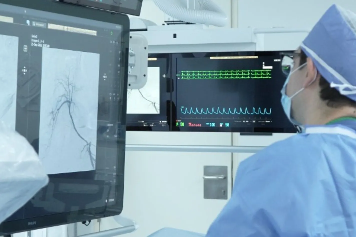 TecSalud, pionero en radioembolización hepática en el norte del país