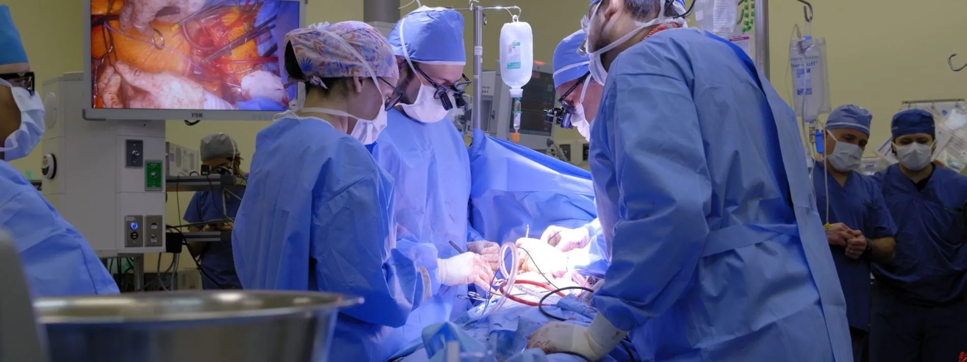 TecSalud realiza implante cardiaco pionero para falla cardiaca severa