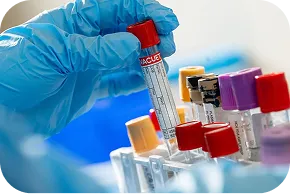 Área de procesamiento de muestras